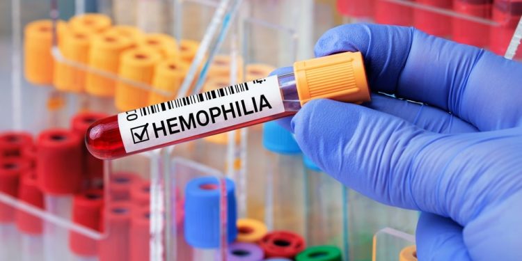 L’hémophilie, une maladie toujours méconnue