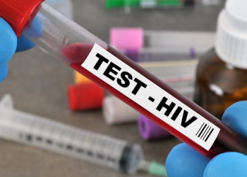 Le Sénégal passe de 5 000 à 900 nouveaux cas d’infections au VIH Sida par an