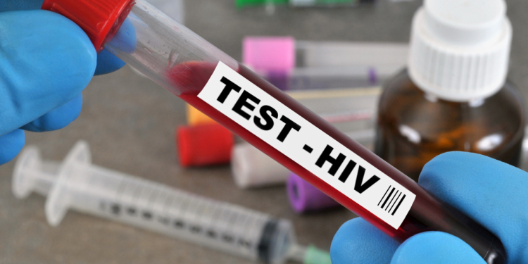 Le Sénégal passe de 5 000 à 900 nouveaux cas d’infections au VIH Sida par an