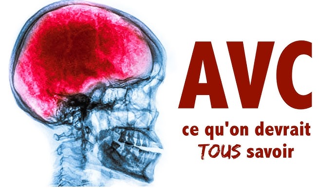 Contre l’AVC, la médecin Dr Esther KEMAVO conseille la formule magique