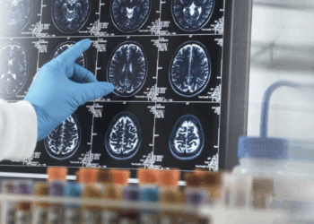 11 millions de morts chaque année : l’OMS alerte sur les maladies neurologiques