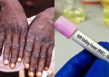 Sénégal : La FVR tue, le Mpox contenu !