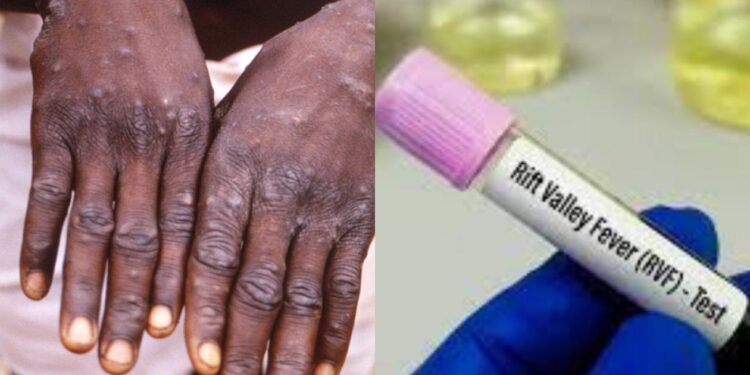 Sénégal : La FVR tue, le Mpox contenu !