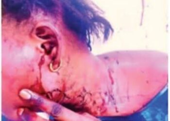 Touba : une infirmière d’État agresse sa coépouse et tente de tromper la police