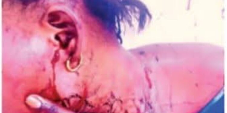 Touba : une infirmière d’État agresse sa coépouse et tente de tromper la police