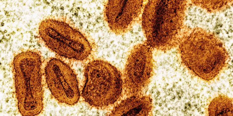 Deux virologues inculpés aux Etats-Unis pour avoir tenté d&rsquo;importer le virus mpox d&rsquo;Afrique